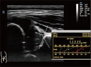 Клинические изображения УЗИ аппарат Chison SonoTouch 80 портативный