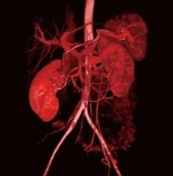 Клинические изображения Canon ASTELION 16 (32) Компьютерный томограф