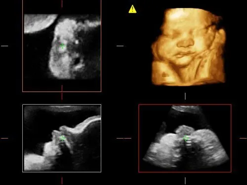 Клинические изображения УЗИ аппарат Esaote MyLab ClassC