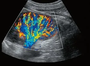 Клинические изображения УЗИ аппарат Chison i8