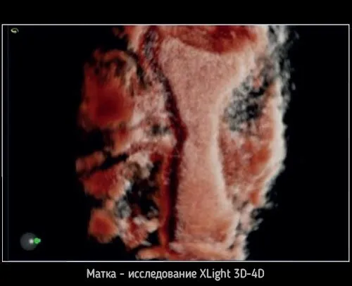 Клинические изображения УЗИ аппарат Esaote MyLab X8