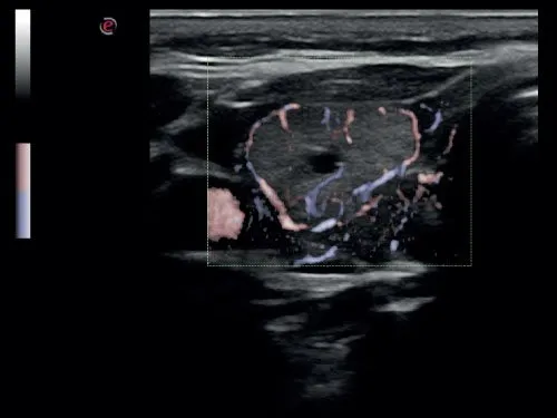 Клинические изображения УЗИ аппарат Esaote MyLab Six