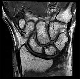 Клинические изображения МРТ аппарат GE SIGNA Premier 3T