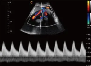 Клинические изображения УЗИ аппарат Chison SonoTouch 80 портативный