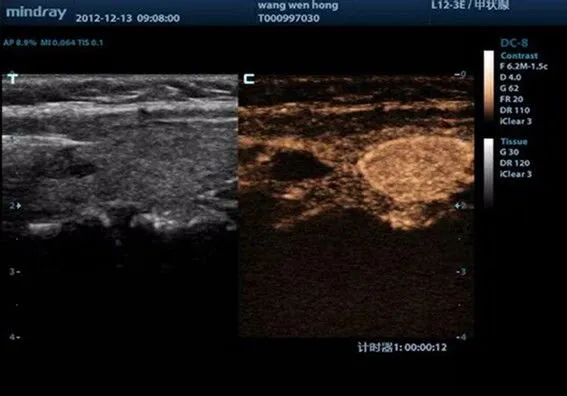 Клинические изображения УЗИ аппарат Mindray DC-8