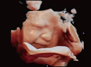 Клинические изображения УЗИ аппарат Chison i8