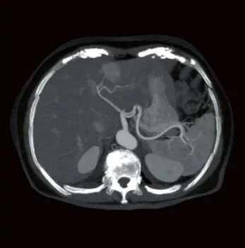 Клинические изображения Canon ASTELION 16 (32) Компьютерный томограф