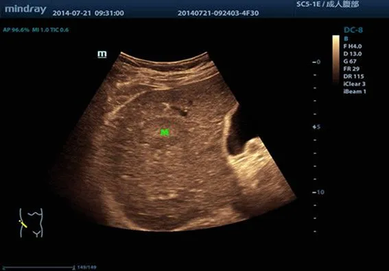Клинические изображения УЗИ аппарат Mindray DC-8 Exp