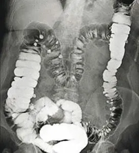 Клинические изображения Цифровой рентгеноcкопический комплекс Italray Clinodigit Оmega