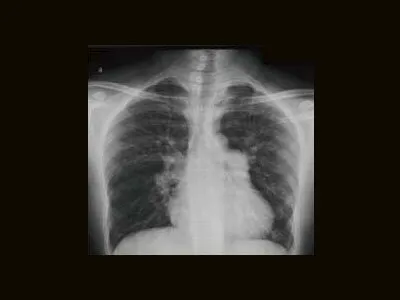 Клинические изображения Brivo XR575 цифровой рентгенографический аппарат GE HealthCare