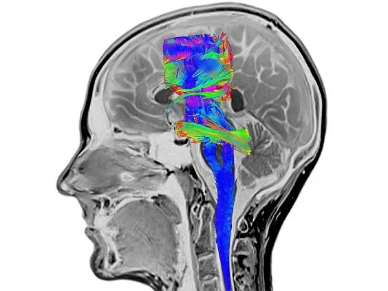 Клинические изображения Магнитно-резонансный томограф Siemens MAGNETOM Prisma 3T