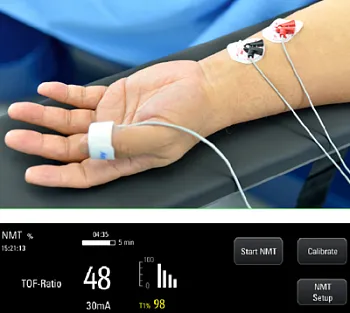 Наркозный аппарат Mindray A8