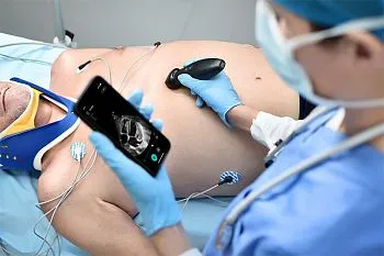 УЗИ аппарат Mindray TEAir