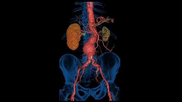 Клинические изображения Компьютерный томограф GE Revolution Maxima