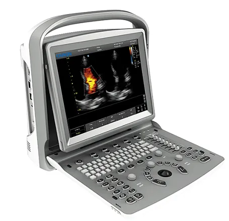 УЗИ аппарат Chison ECO 6