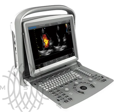 УЗИ аппарат Chison ECO 6