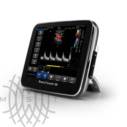 Chison SonoTouch 30 портативный УЗИ аппарат