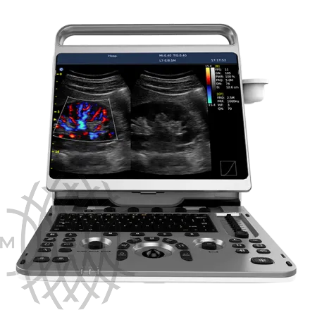 Chison EBit 50 ультразвуковой аппарат