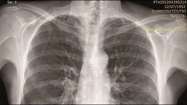 Клинические изображения Цифровой рентгеноcкопический аппарат GE Discovery RF180