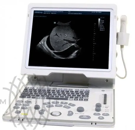 УЗИ аппарат Mindray DP-50 портативный