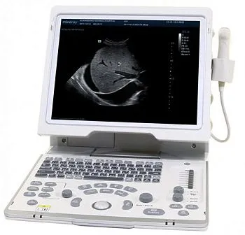 УЗИ аппарат Mindray DP-50 портативный