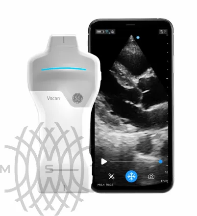 УЗИ аппарат GE HealthCare Vscan Air карманный