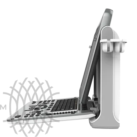 Chison EBit 30 ультразвуковой аппарат