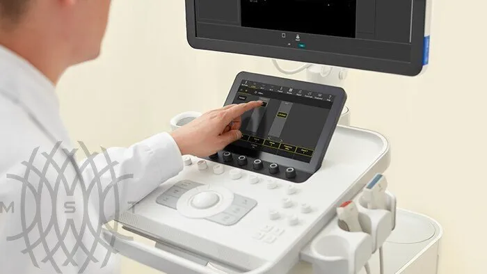 УЗИ аппарат Philips 3300