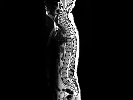 Клинические изображения Магнитно-резонансный томограф GE HealthCare Optima MR450w