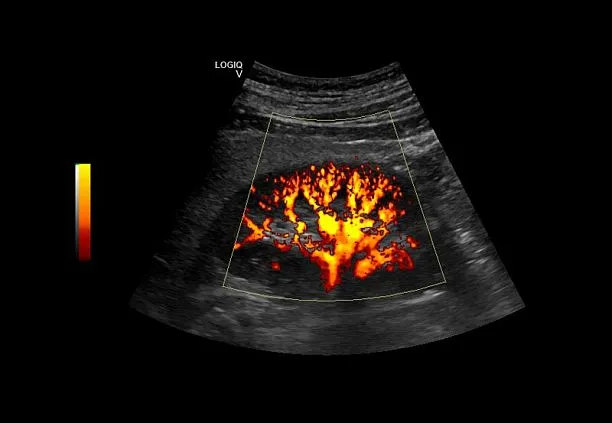Клинические изображения УЗИ аппарат GE HealthCare Vscan Air карманный