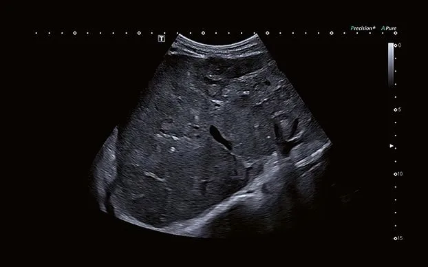 Клинические изображения Canon (Toshiba) Aplio i700 аппарат УЗИ