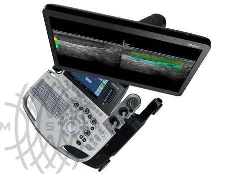 GE Logiq S8 XDclear ультразвуковая диагностическая система