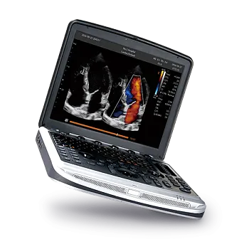 УЗИ аппарат Chison SonoBook 8 портативный
