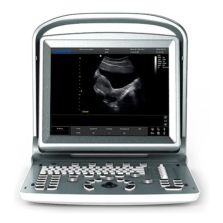 УЗИ аппарат Chison ECO 5