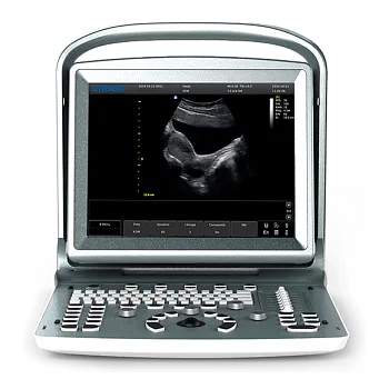 Ультразвуковой аппарат Chison SonoTouch 20