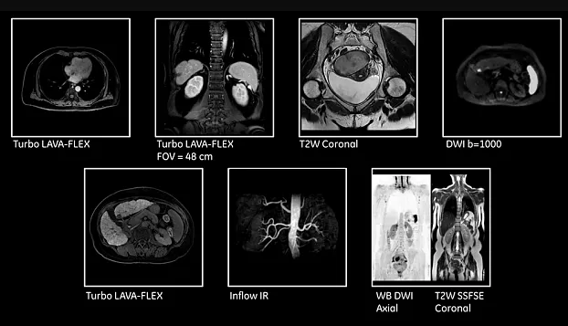 Клинические изображения МРТ аппарат GE SIGNA Pioneer 3T