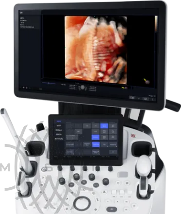 УЗИ аппарат НПО СКАНЕР РУСКАН 65М