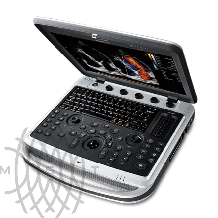 УЗИ аппарат Chison SonoBook 8 портативный