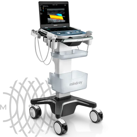 Портативный УЗИ аппарат Mindray MX8 Exp