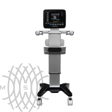 Chison SonoTouch 30 портативный УЗИ аппарат