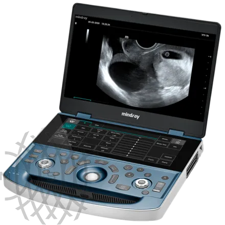 Портативный УЗИ аппарат Mindray MX8 Exp