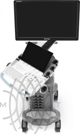 УЗИ аппарат SonoScape ProPet 80