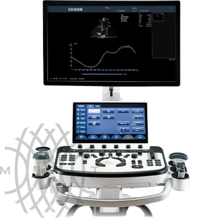 Chison XBit 90 ультразвуковой аппарат