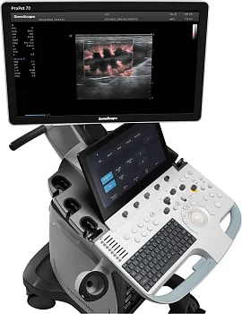 УЗИ аппарат SonoScape ProPet 70