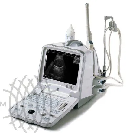 УЗИ аппарат Mindray DP 6600