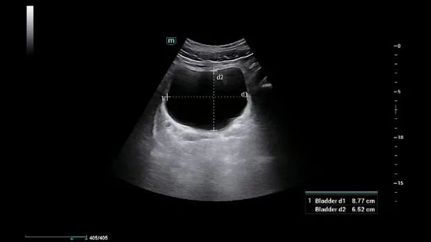 Клинические изображения УЗИ аппарат Mindray Consona N6