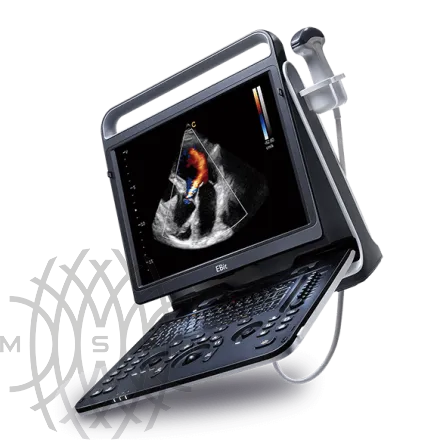 Chison EBit 60 аппарат УЗИ