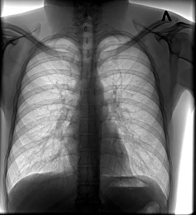 Клинические изображения Флюорограф цифровой С.П.Гелпик РЕНЕКС Ф-5000