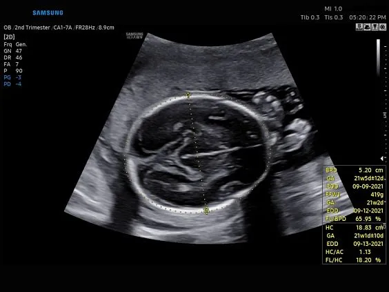 Клинические изображения Samsung Medison W9 УЗИ аппарат