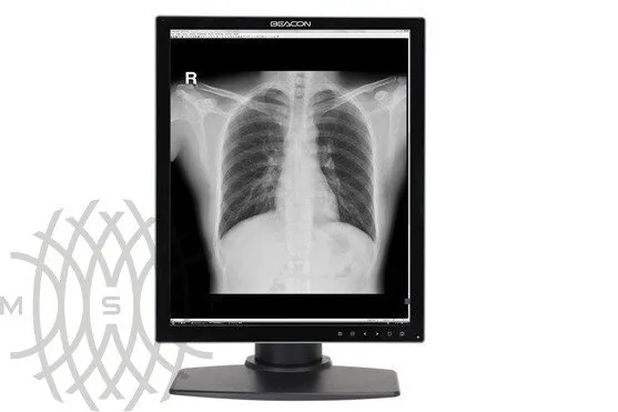 Монитор медицинский Millennium G32SP